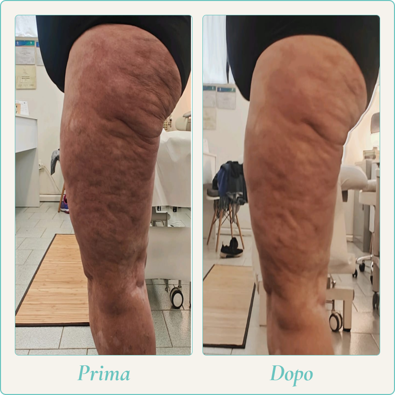 Prima e dopo 2