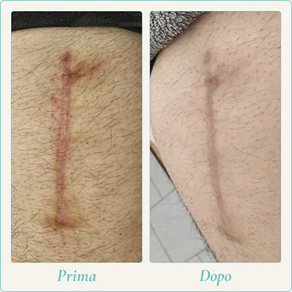 Prima e dopo 3