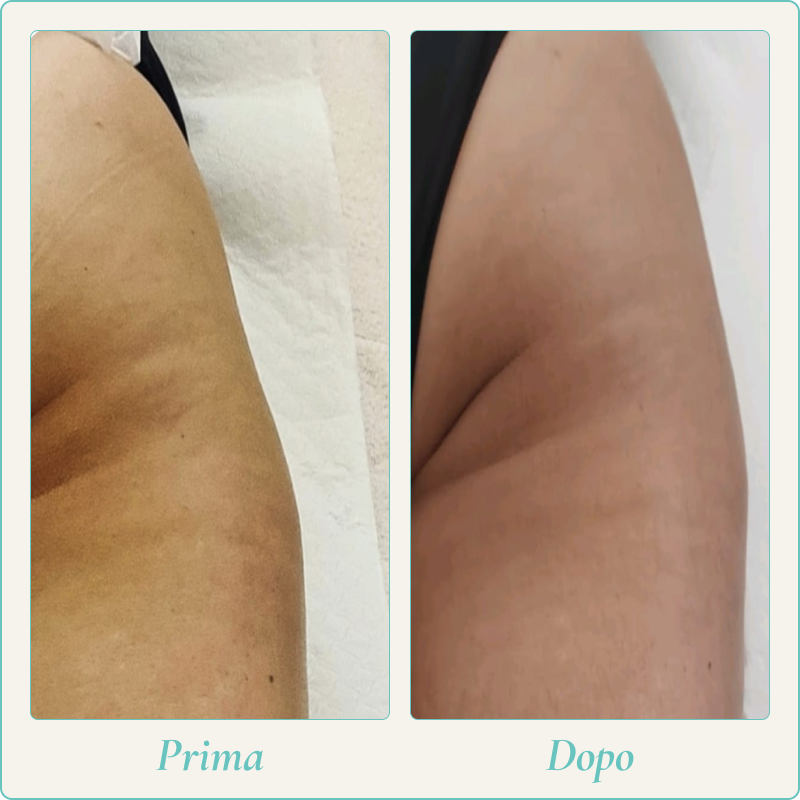 Prima e dopo 4