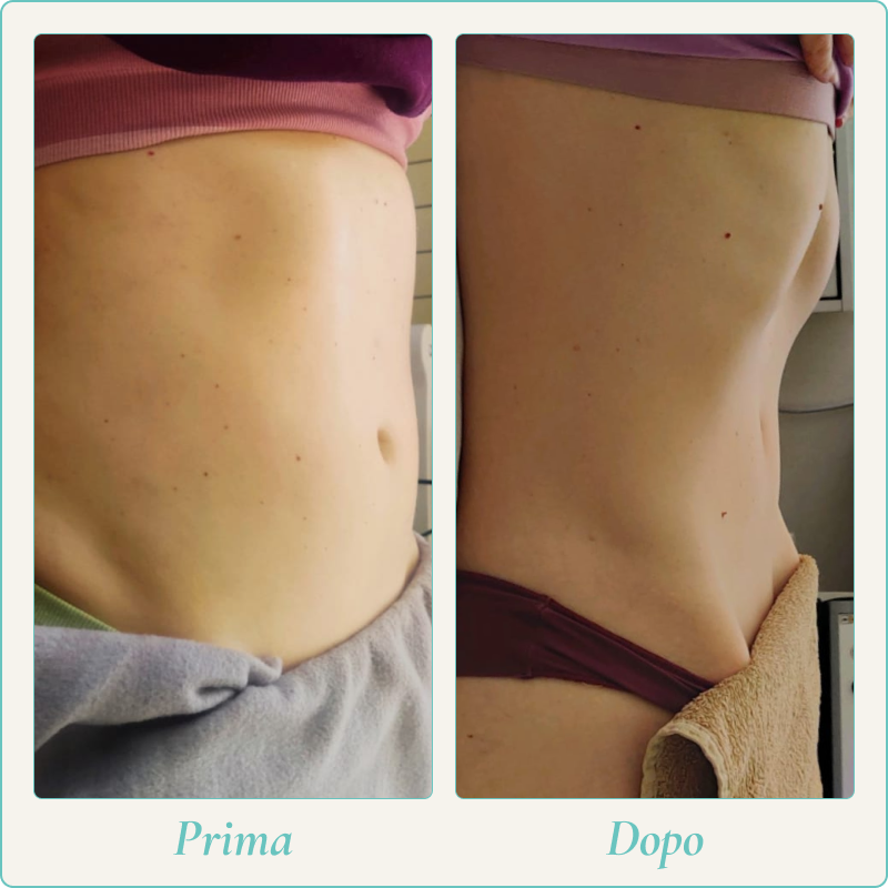 Prima e dopo 5