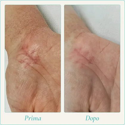 Prima e dopo 4